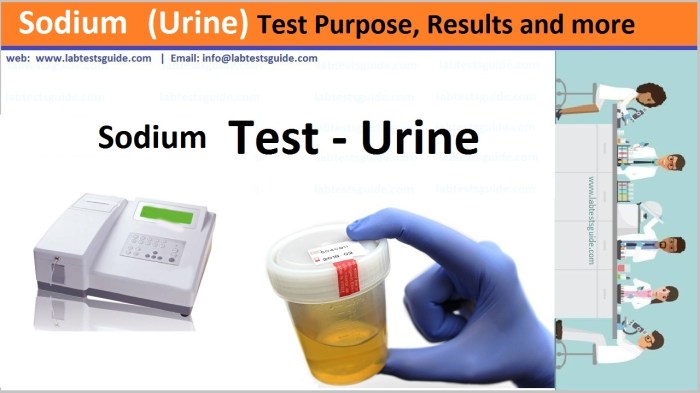 Urine excretion estimation sodium hour